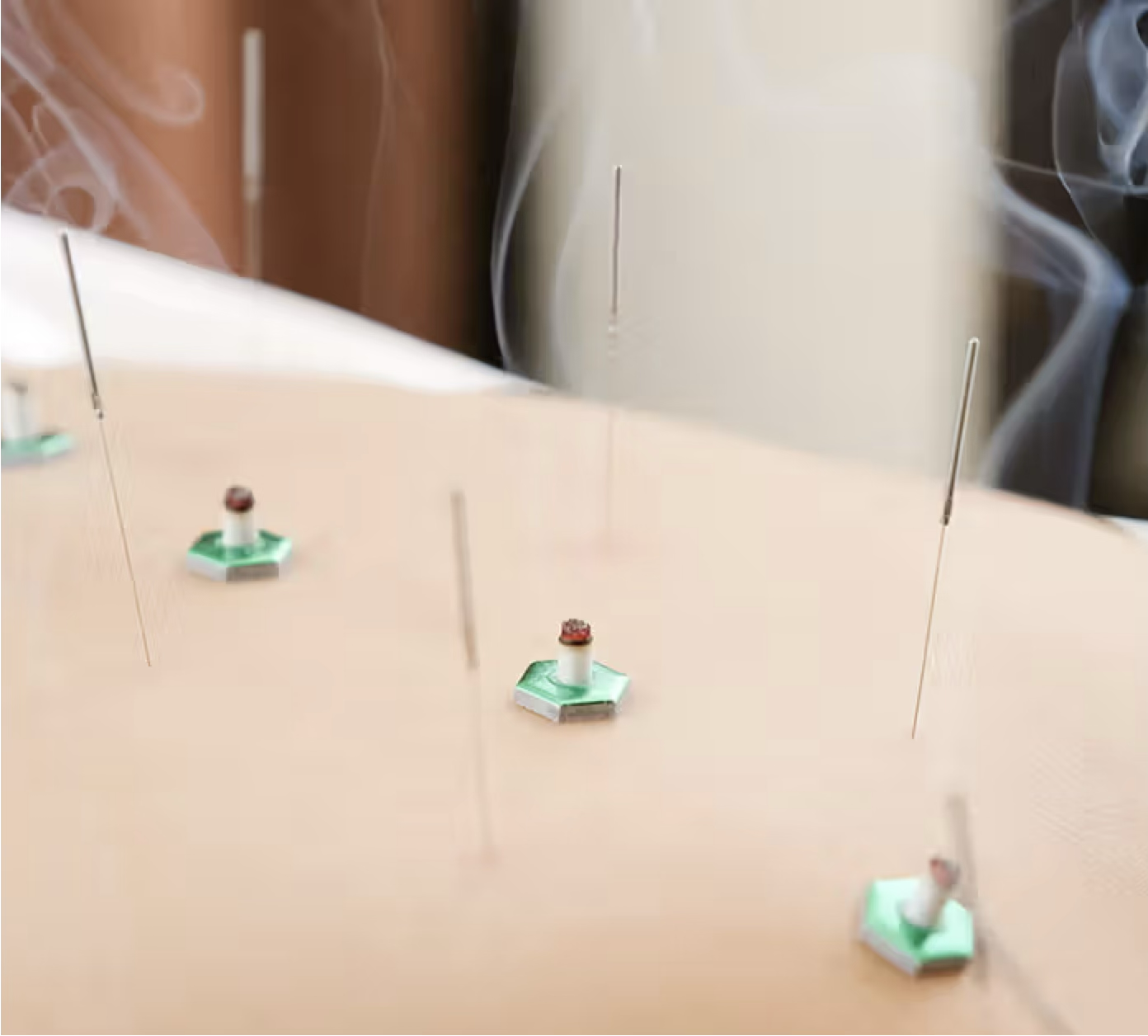 Moxibustion
